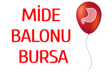 Bursa Mide Balonu | Obezite ve Mide Balonu